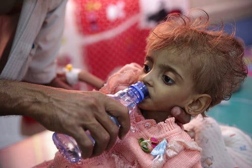 Τραγωδία δίχως τέλος στην Υεμένη: 8 παιδιά σκοτώνονται ή τραυματίζονται καθημερινά. Η επικεφαλής της Ύπατης Αρμοστείας του ΟΗΕ...
