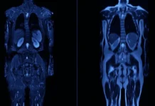 Οι ολόσωμες μαγνητικές τομογραφίες μπαίνουν στη ζωή μας